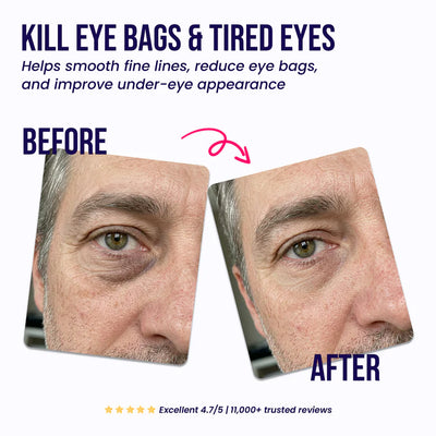 Under-Eye Repair Patches